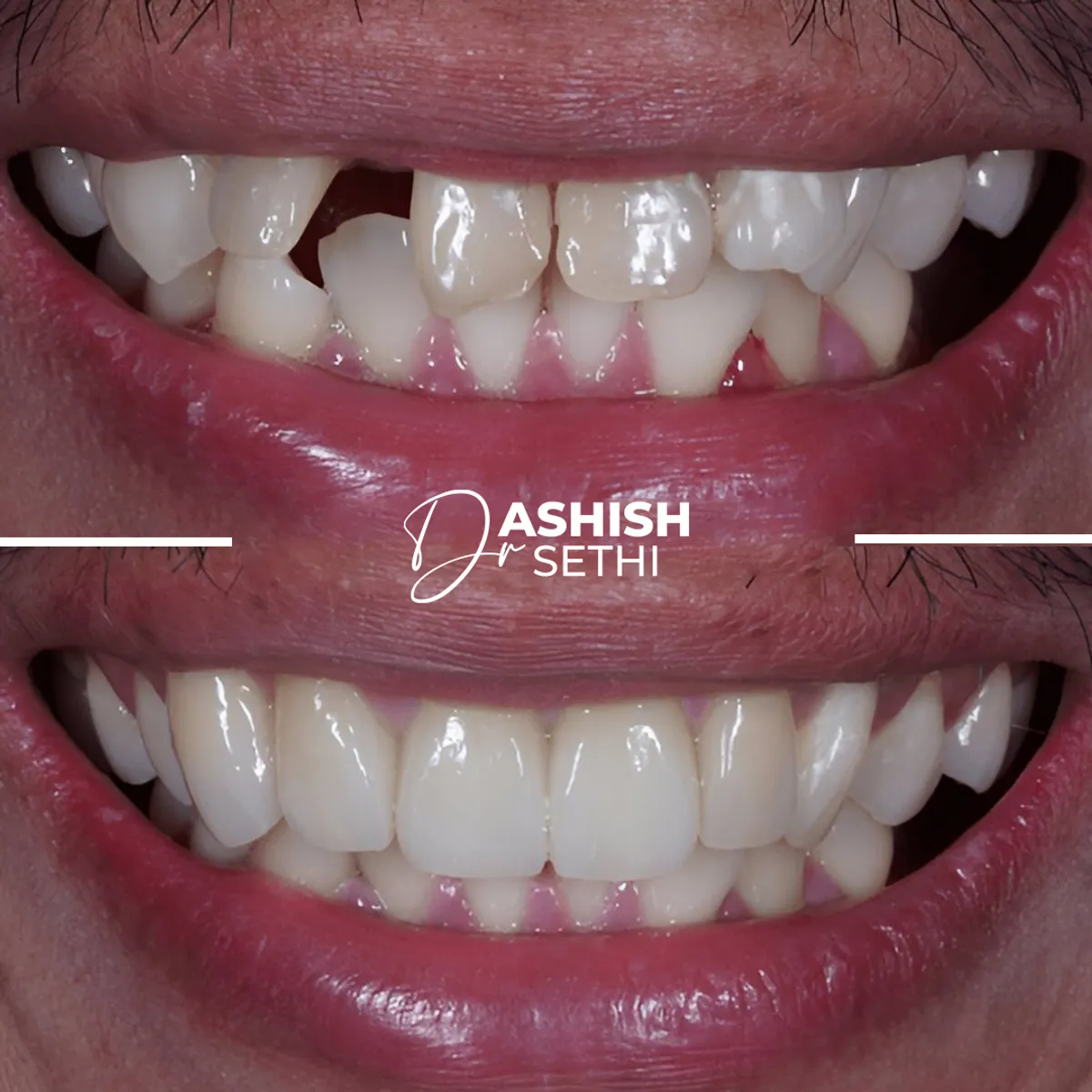 Before and After Transformation 3